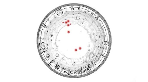Prostatit belirtileriniz varsa gizli enfeksiyonlar açısından test yaptırmalısınız.
